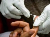 Brzo testiranje na HIV u centru Niša