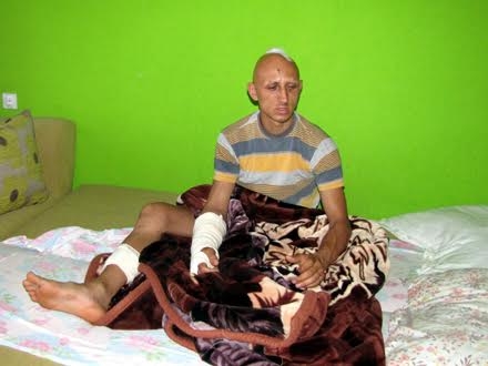 Kostić pretučen palicama, sa teškim povredama FOTO D. Ristić/OK Radio 