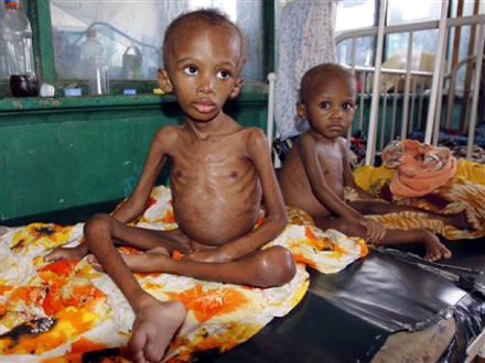 Broj gladnih u svetu prošle godine porastao za 10 miliona FOTO: AP