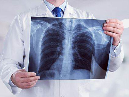 Sačinjen 181 rentgen pluća za 24 časa FOTO: Shutterstock