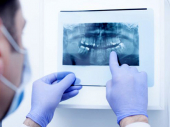 Stomatolog otkriva da li izvađeni zub može da se iskoristi