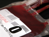 Nove studije potvrđuju uticaj krvne grupe na tok infekcije koronom