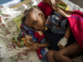Unicef: 30.000 dece bi moglo da umre od gladi u Etiopiji